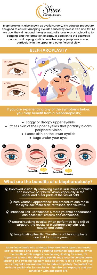 Common questions asked by clients: What is a blepharoplasty? Who is a good candidate for a blepharoplasty? How long does a blepharoplasty procedure take? How long does a blepharoplasty last? Dr. Daniel Lin, D.O. at Shine Cosmetic Surgery offers blepharoplasty. For more information, contact us or request an appointment online. We are conveniently located at 2707 E Valley Blvd Suite 115, West Covina, CA 91792. We serve clients from West Covina CA, San Gabriel Valley CA, Rowland heights CA, Walnut CA, Rosemead CA, and surrounding areas.