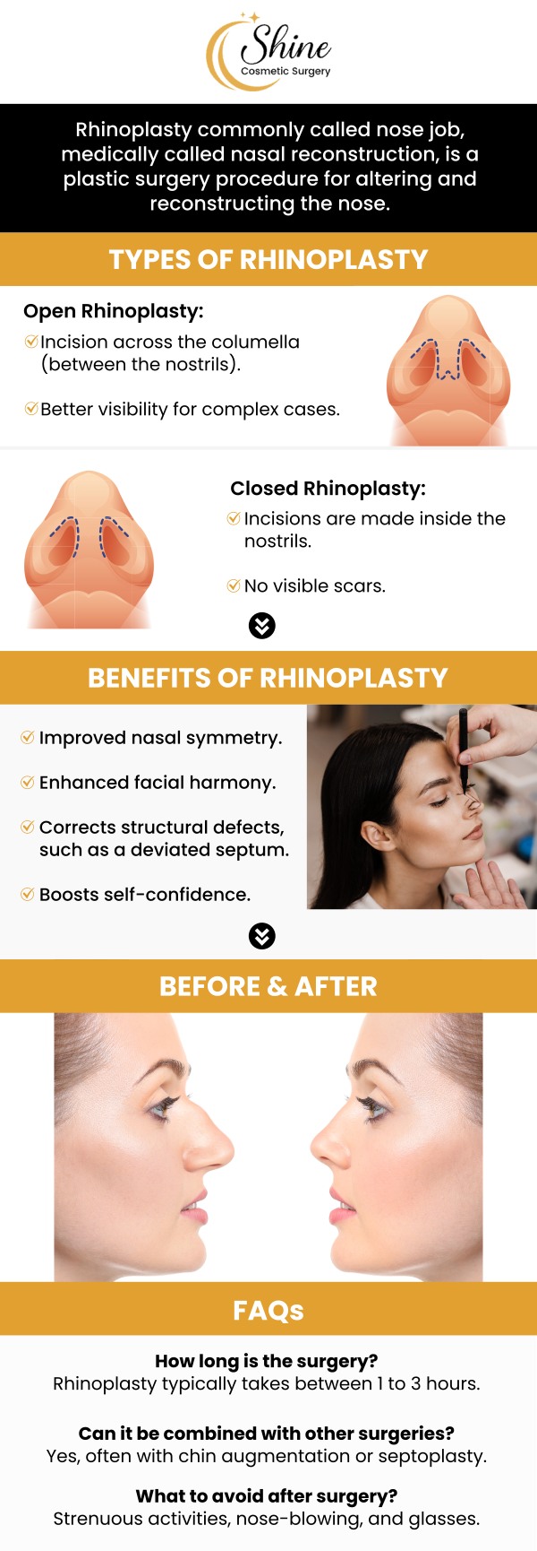 Experience the transformative power of rhinoplasty with real before and after results from Shine Cosmetic Surgery, proudly serving West Covina and the San Gabriel Valley. Dr. Daniel Lin, D.O., brings expert precision and artistry to every procedure, helping patients achieve natural, balanced facial harmony. For more information, contact us or request an appointment online. We are conveniently located at 2707 E Valley Blvd Suite 115, West Covina, CA 91792. Experience the transformative power of rhinoplasty with real before and after results from Shine Cosmetic Surgery, proudly serving West Covina and the San Gabriel Valley. Dr. Daniel Lin, D.O., brings expert precision and artistry to every procedure, helping patients achieve natural, balanced facial harmony. For more information, contact us or request an appointment online. We are conveniently located at 2707 E Valley Blvd Suite 115, West Covina, CA 91792.